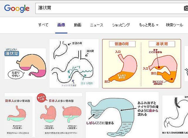 瀑状胃