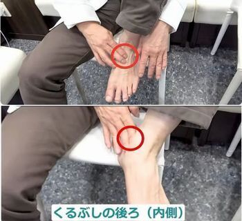 足の動脈の拍動確認